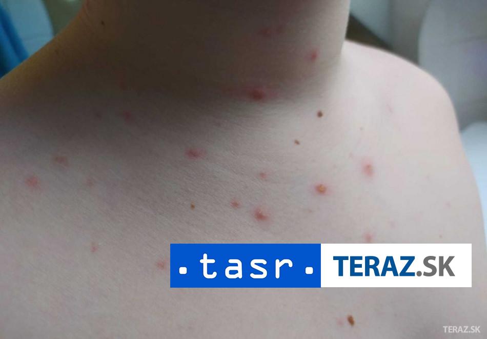Na osypky v Bangladesi zomrelo takmer 500 det