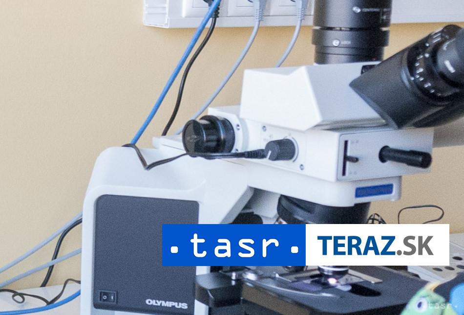 Vyskyt hantavrusu na Slovensku doteraz nebol laboratorne potvrdeny tvrdi urad
